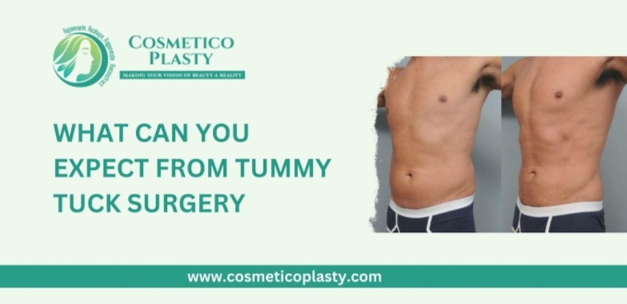 What can you expect from tummy tuck?