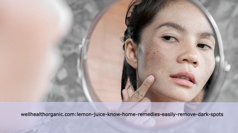 wellhealthorganic.com:lemon-juice-know-home-remedies-easily-remove-dark-spots