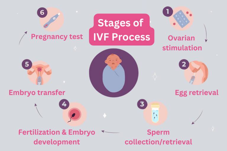 The IVF Process Explained: What To Expect At Every Stage?