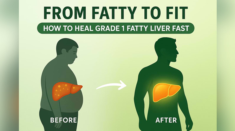 How to Heal Grade 1 Fatty Liver Fast