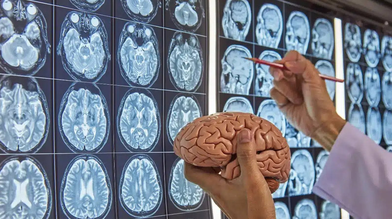 Traumatic Brain Injury Claims After Colorado Crash